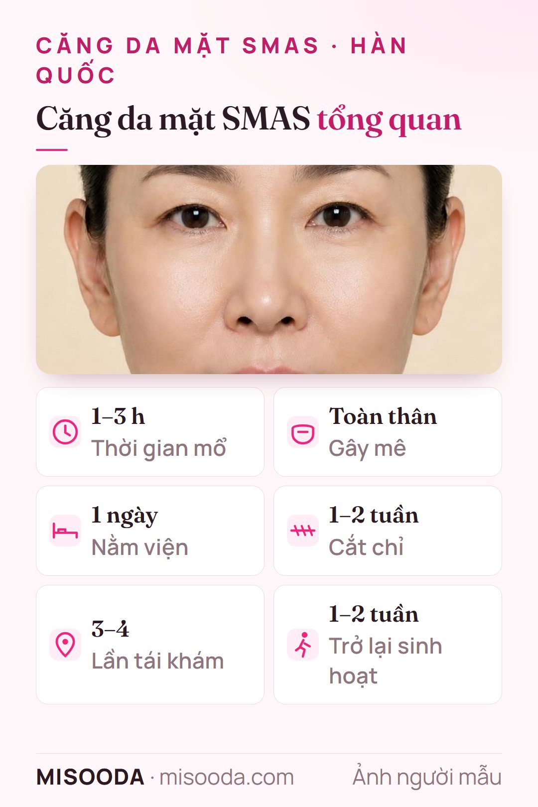 Thông tin nhanh căng da mặt SMAS: 1–3 giờ, gây mê toàn thân, nằm viện 1 ngày, cắt chỉ sau 1–2 tuần, 3–4 lần tái khám
