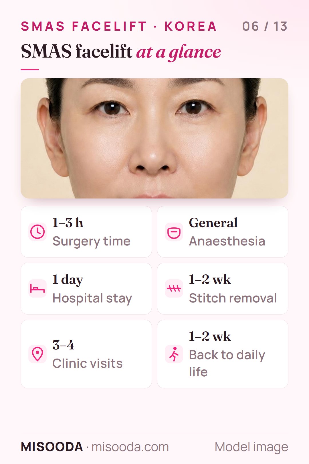SMAS facelift quick facts: 1–3 hours, general anaesthesia, 1-day hospital stay, stitches out at 1–2 weeks, 3–4 clinic visits