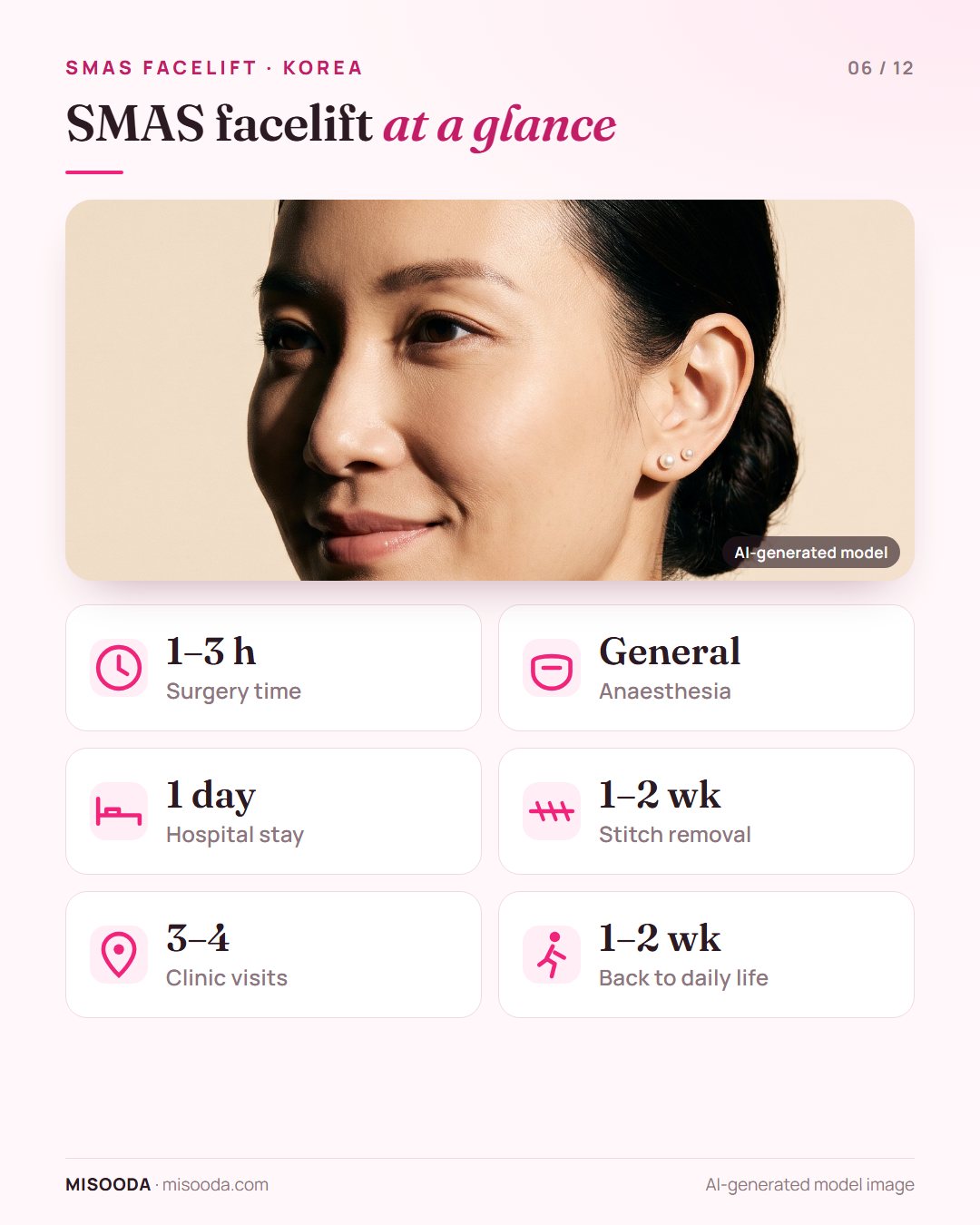 SMAS facelift quick facts: 1–3 hours, general anaesthesia, 1-day hospital stay, stitches out at 1–2 weeks, 3–4 clinic visits