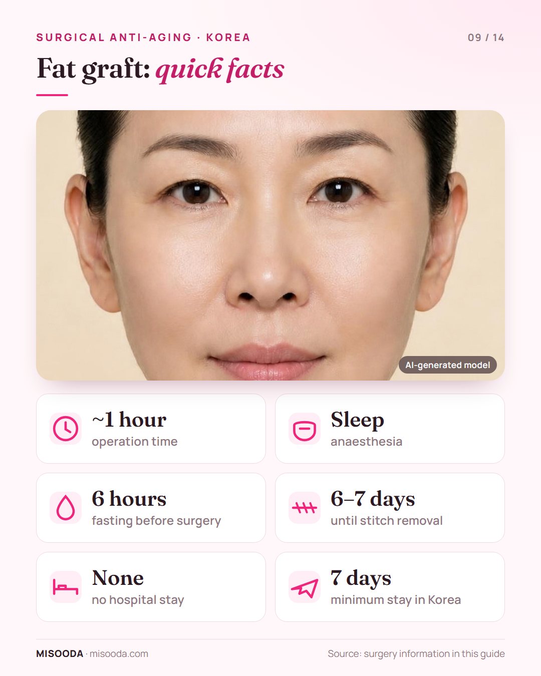 Facial fat graft in Korea quick facts: about 1 hour under sleep anaesthesia, 6 hours fasting, stitches out at 6–7 days, stay at least 7 days