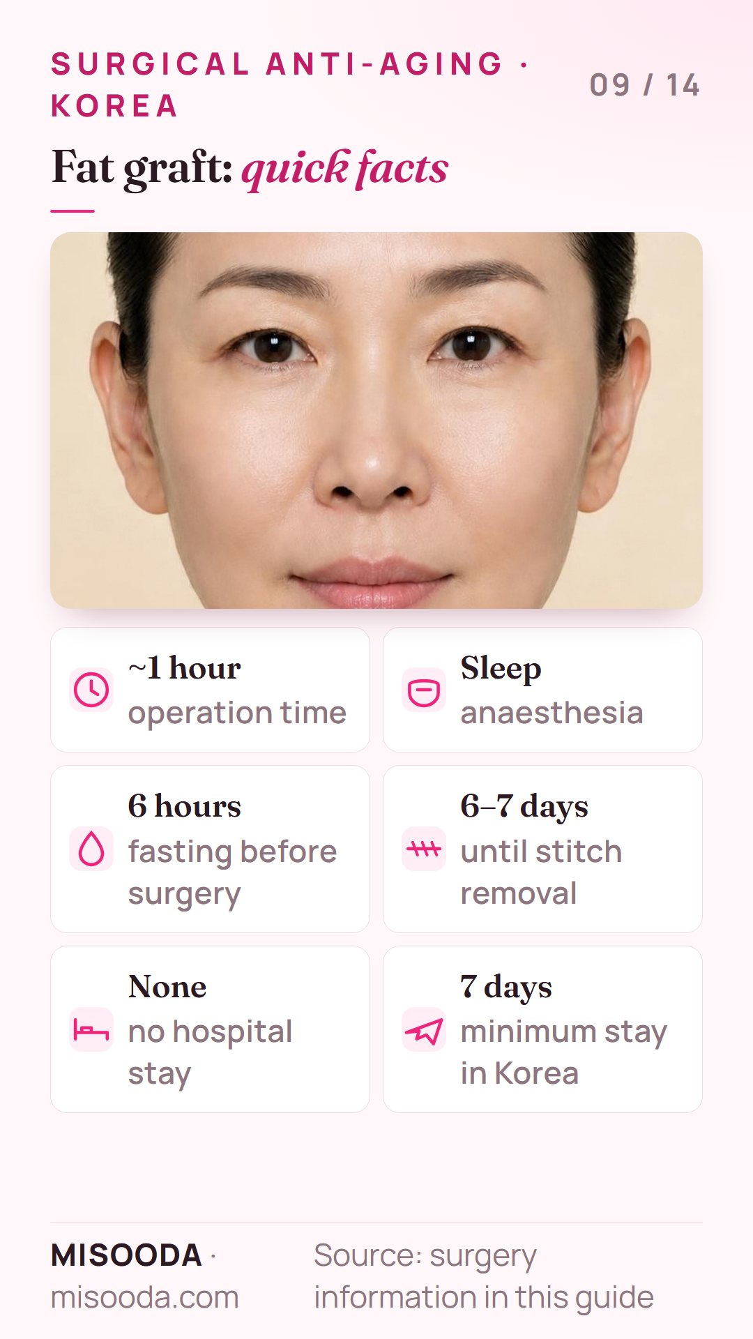 Facial fat graft in Korea quick facts: about 1 hour under sleep anaesthesia, 6 hours fasting, stitches out at 6–7 days, stay at least 7 days