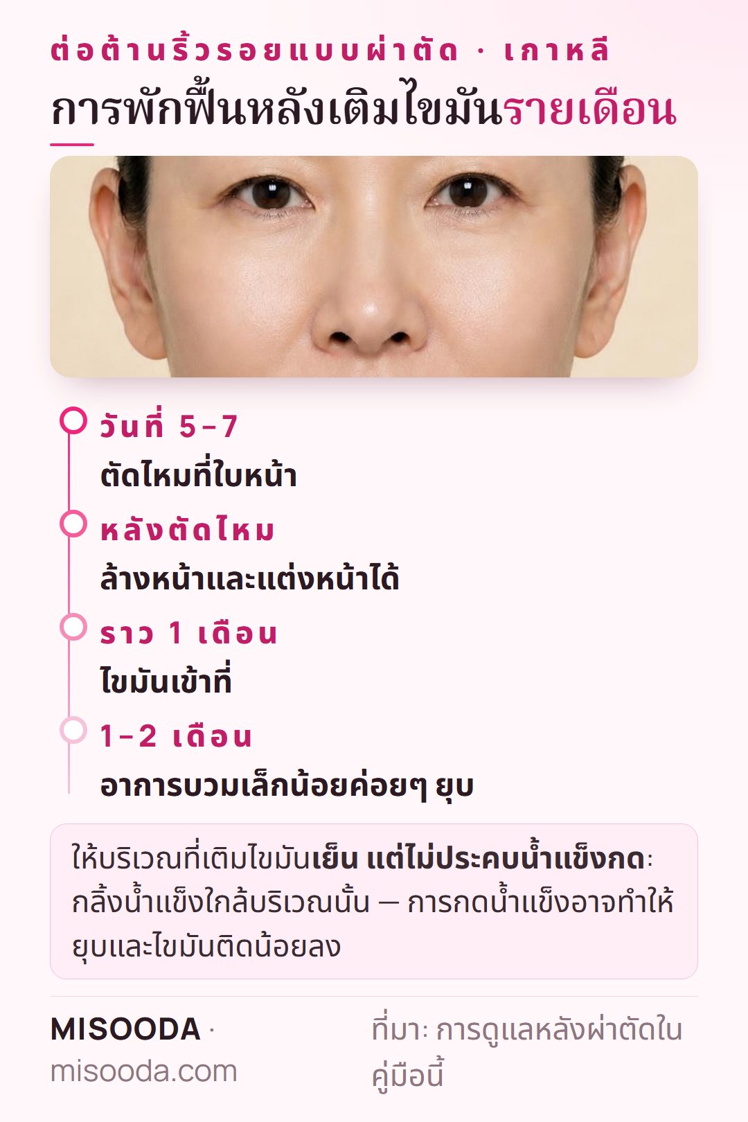 ไทม์ไลน์พักฟื้นเติมไขมัน เกาหลี: ตัดไหมที่ใบหน้า 5–7 วัน ไขมันเข้าที่ราว 1 เดือน บวมเล็กน้อย 1–2 เดือน หลีกเลี่ยงการลดน้ำหนัก