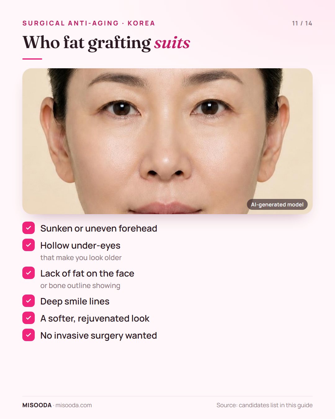 Fat graft candidates: sunken forehead, hollow under-eyes, lack of facial fat, deep smile lines, wanting a softer look without invasive surgery