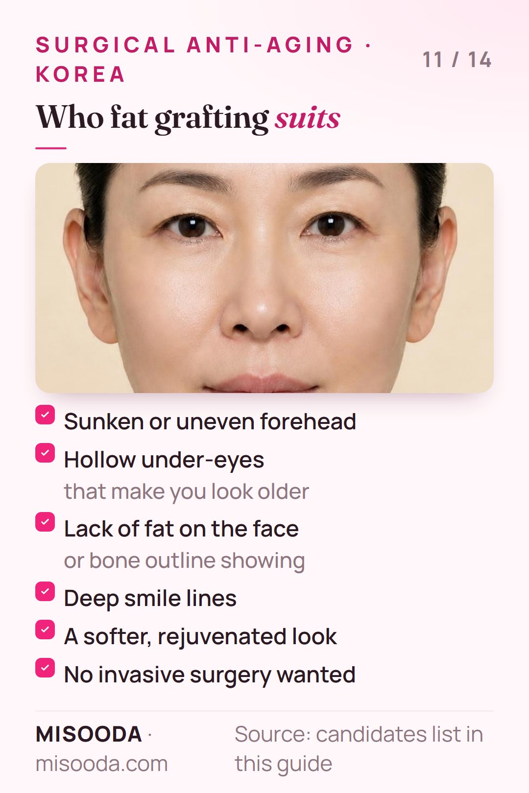 Fat graft candidates: sunken forehead, hollow under-eyes, lack of facial fat, deep smile lines, wanting a softer look without invasive surgery
