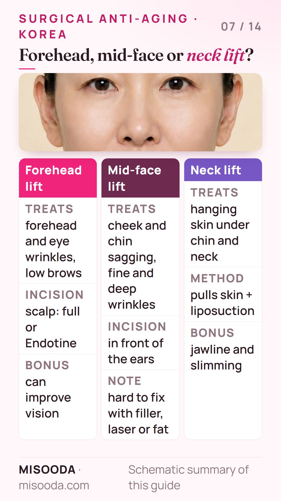 Forehead lift vs mid-face lift vs neck lift compared: what each treats, where the incision goes and extra benefits such as vision or jawline