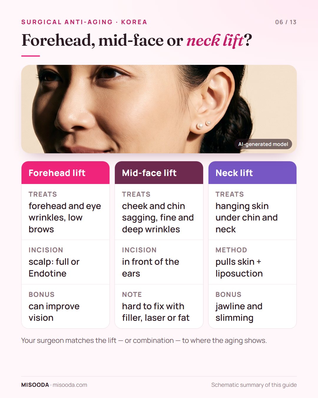 Forehead lift vs mid-face lift vs neck lift compared: what each treats, where the incision goes and extra benefits such as vision or jawline