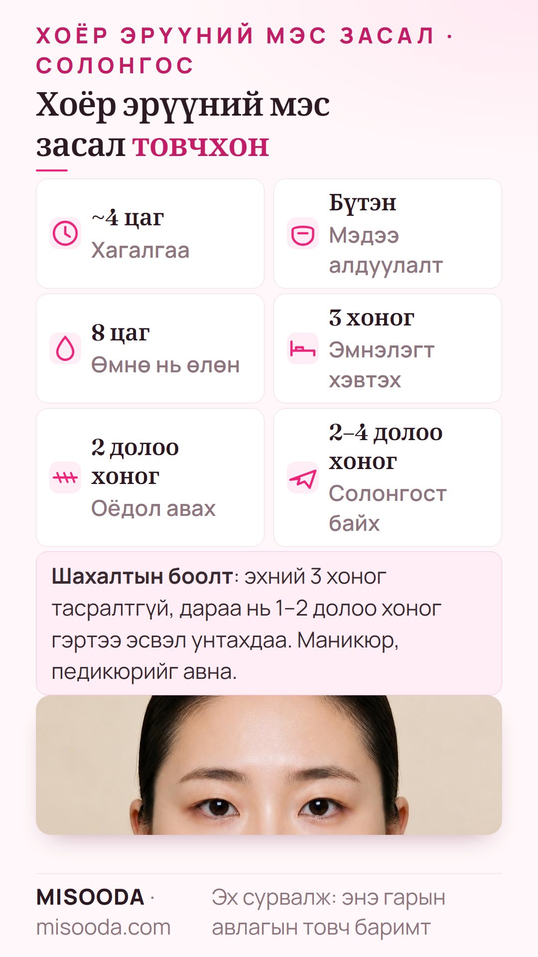 Хоёр эрүүний мэс заслын товч баримт: бүтэн мэдээ алдуулалттай 4 цаг орчим, 8 цагийн өмнөөс өлөн, эмнэлэгт 3 хоног, оёдол 2 долоо хоногт, Солонгост 2–4 долоо хоног