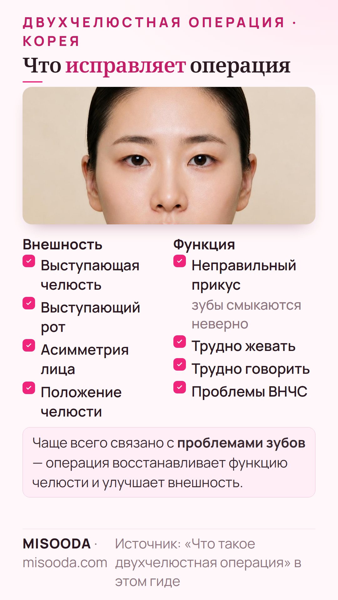 Что исправляет двухчелюстная операция: выступающую челюсть, выступающий рот, асимметрию лица и положение челюсти, а также неправильный прикус и трудности с жеванием и речью