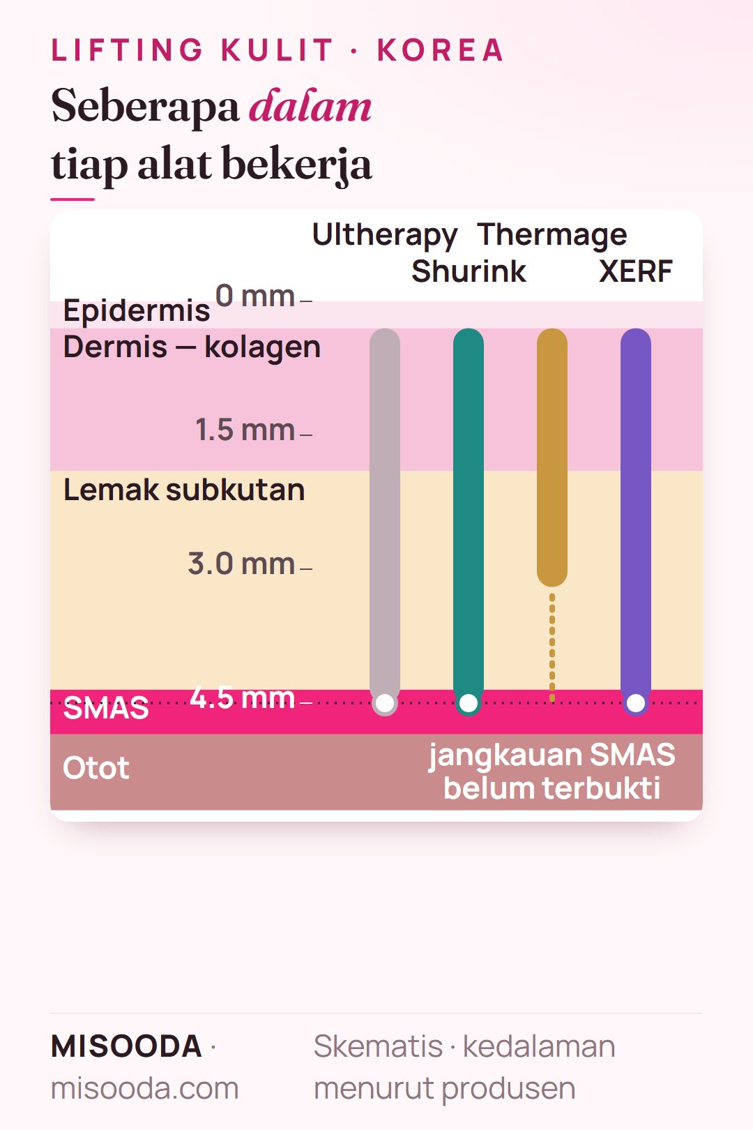 Diagram kedalaman perawatan lifting kulit di Korea: Ultherapy, Shurink dan XERF mencapai SMAS di sekitar 4.5 mm; Thermage memanaskan dermis dan lemak, jangkauan SMAS belum terbukti