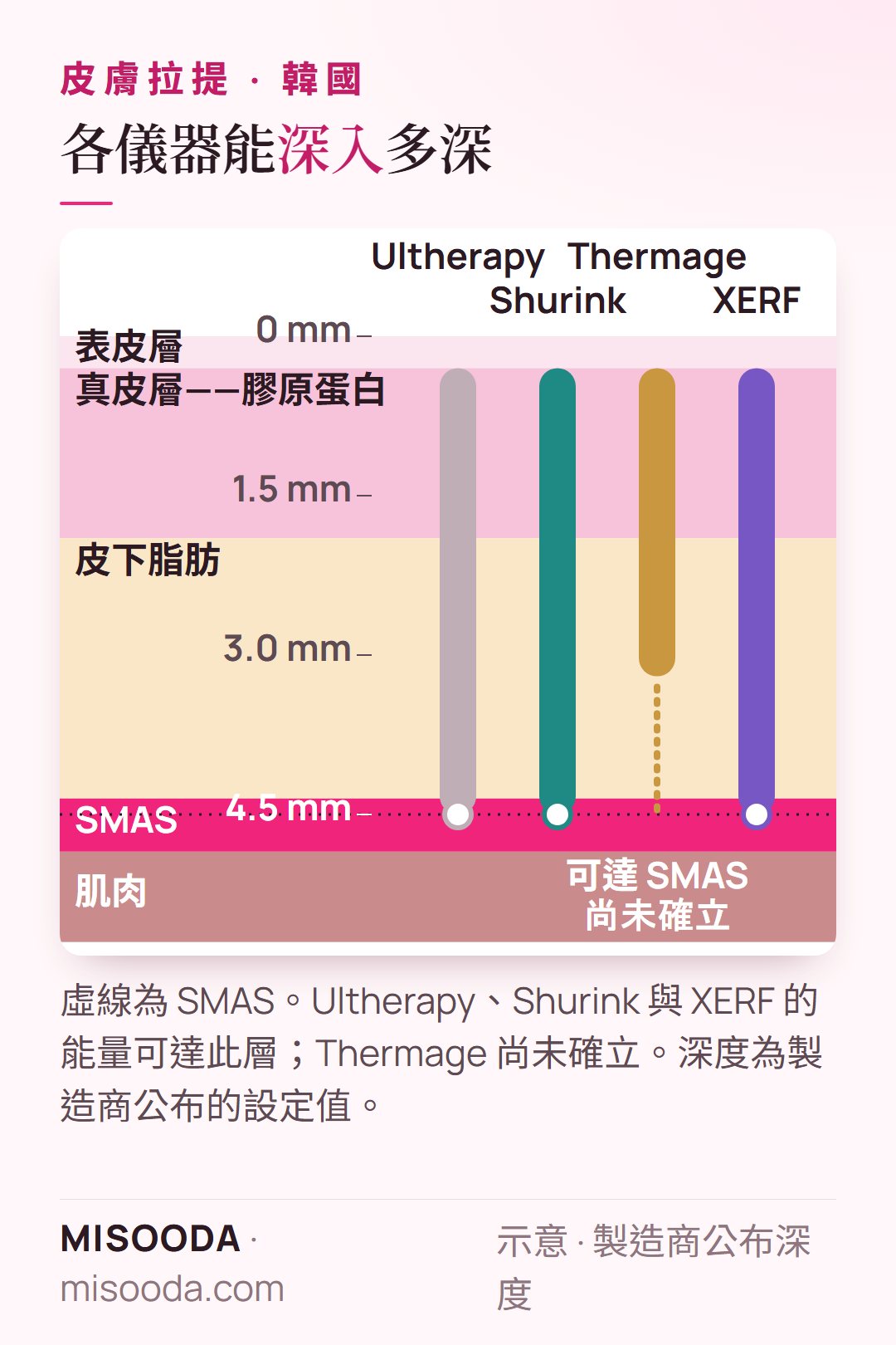 韓國拉提療程深度示意:Ultherapy、Shurink 與 XERF 可達約 4.5 mm 的 SMAS;Thermage 加熱真皮與脂肪層,可達 SMAS 尚未確立