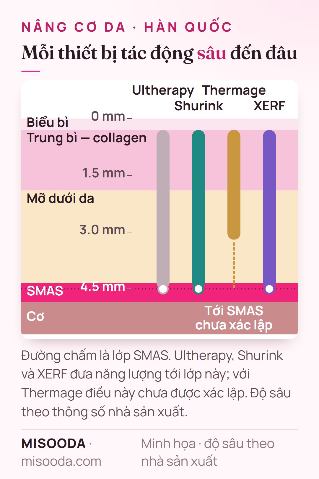 Sơ đồ độ sâu điều trị: Ultherapy, Shurink và XERF tới lớp SMAS ở khoảng 4.5 mm; Thermage làm nóng trung bì và mỡ, chưa xác lập việc tới SMAS
