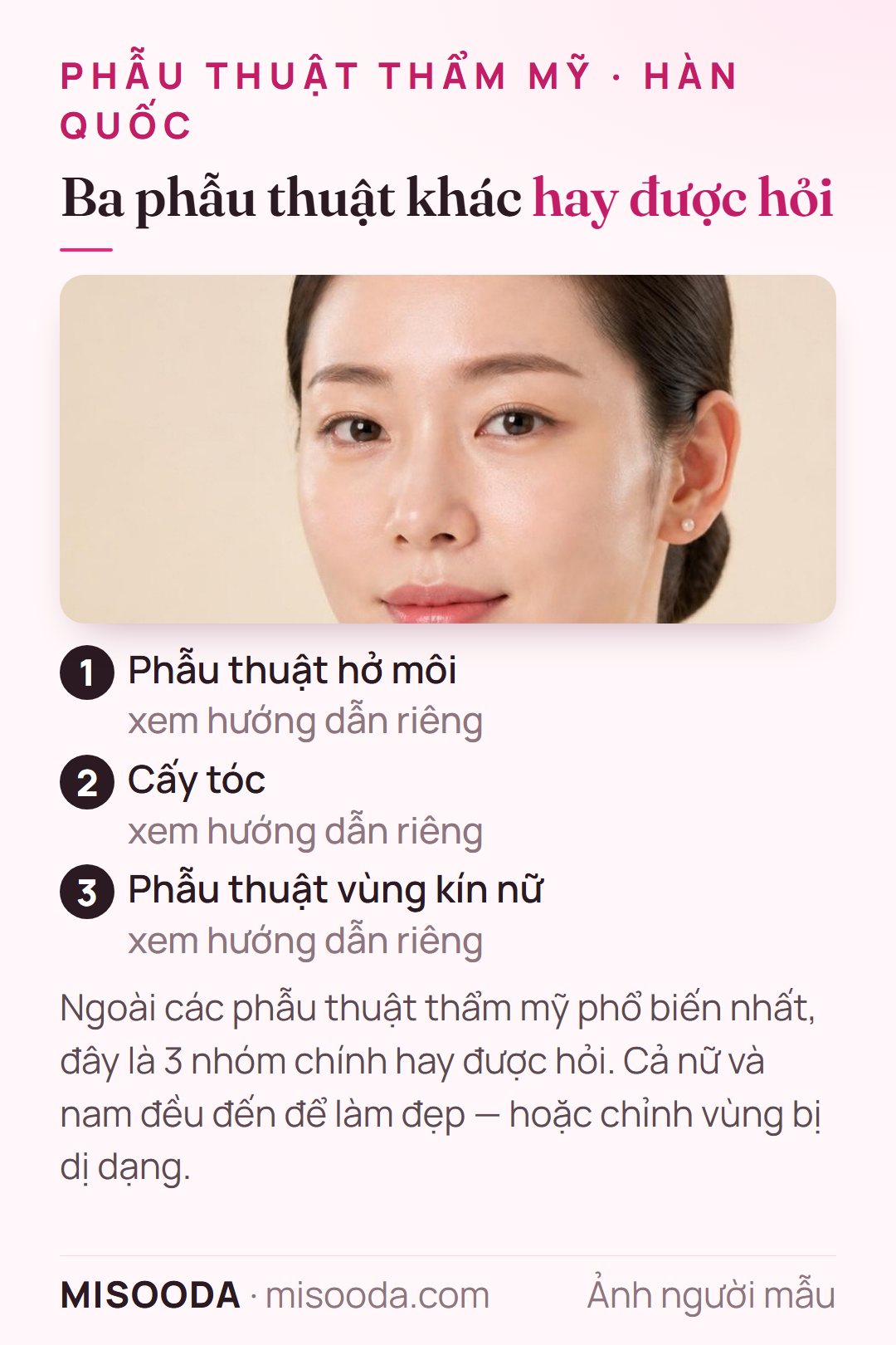 Các phẫu thuật thẩm mỹ Hàn Quốc phổ biến khác ngoài làm đẹp: ba nhóm chính — phẫu thuật hở môi, cấy tóc và phẫu thuật vùng kín nữ