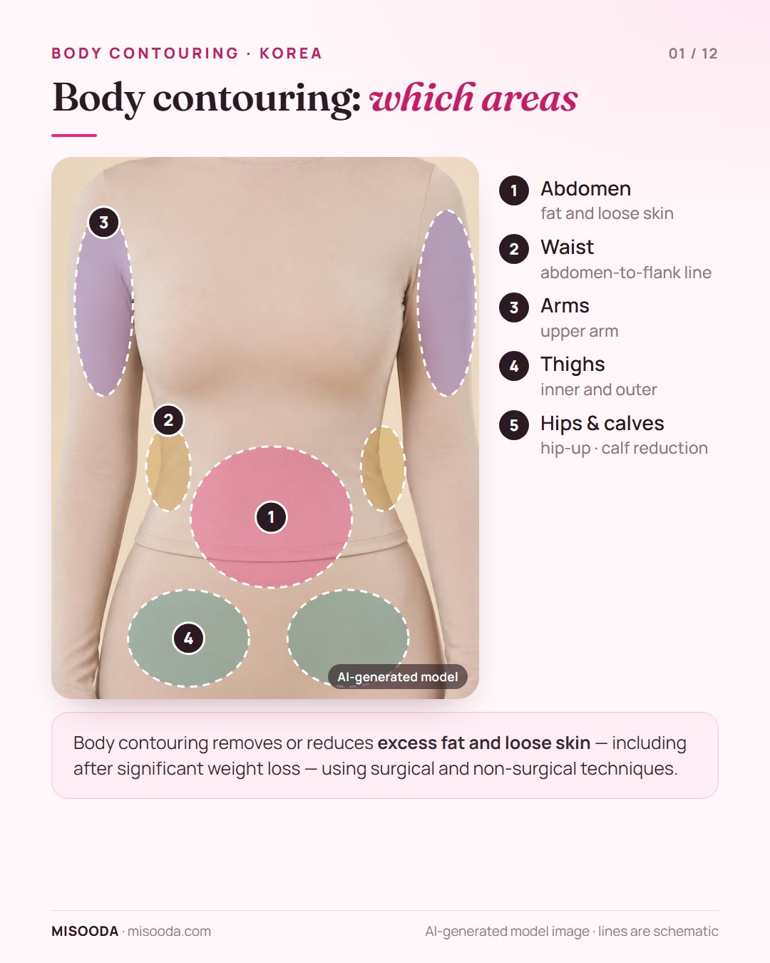 Body contouring treatment areas in Korea on a body: abdomen, waist and flanks, upper arms, thighs, plus hips and calves