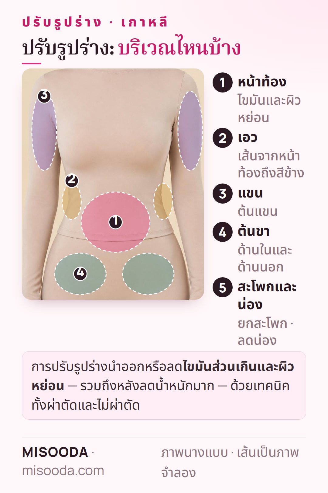 บริเวณปรับรูปร่าง เกาหลี บนร่างกาย: หน้าท้อง เอวและสีข้าง ต้นแขน ต้นขา รวมถึงสะโพกและน่อง