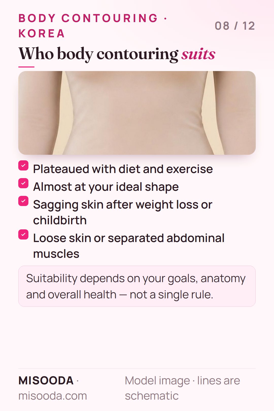 Who body contouring suits: plateaued with diet and exercise, almost at ideal shape, sagging skin after weight loss or childbirth, loose abdominal muscles