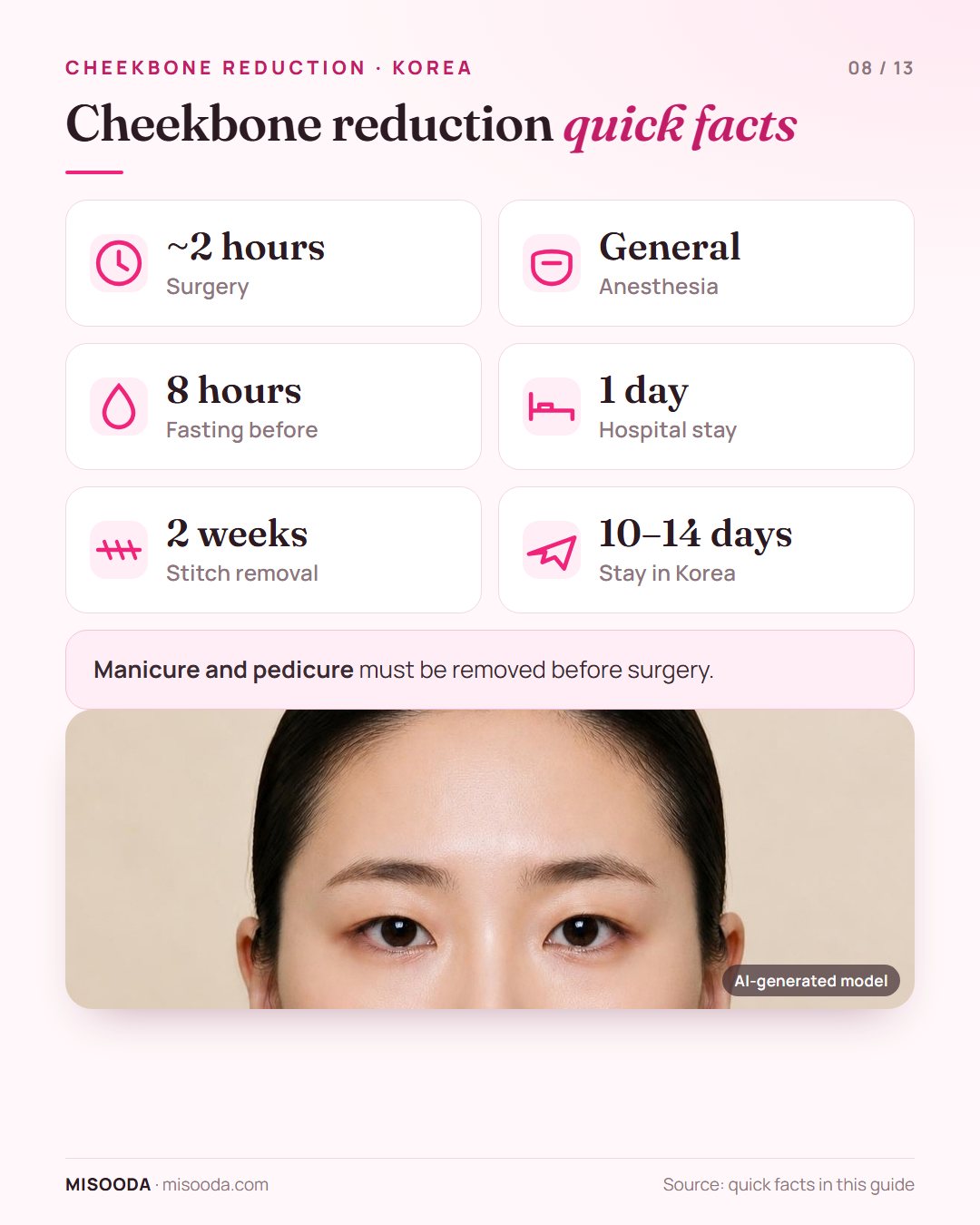 Cheekbone reduction quick facts: about 2 hours under general anesthesia, fasting from 8 hours before, 1 day in hospital, stitches out at 2 weeks, 10–14 days in Korea