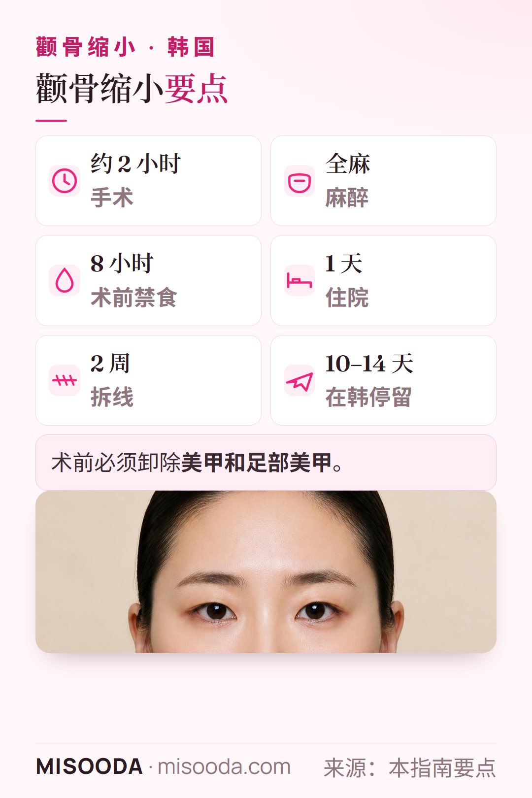 韩国颧骨缩小要点:全麻约 2 小时、术前 8 小时禁食、住院 1 天、2 周拆线、在韩停留 10–14 天