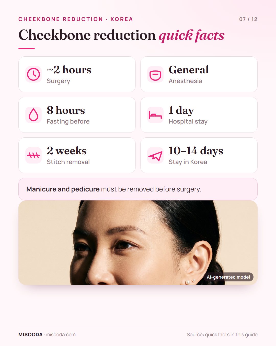 Cheekbone reduction quick facts: about 2 hours under general anesthesia, fasting from 8 hours before, 1 day in hospital, stitches out at 2 weeks, 10–14 days in Korea