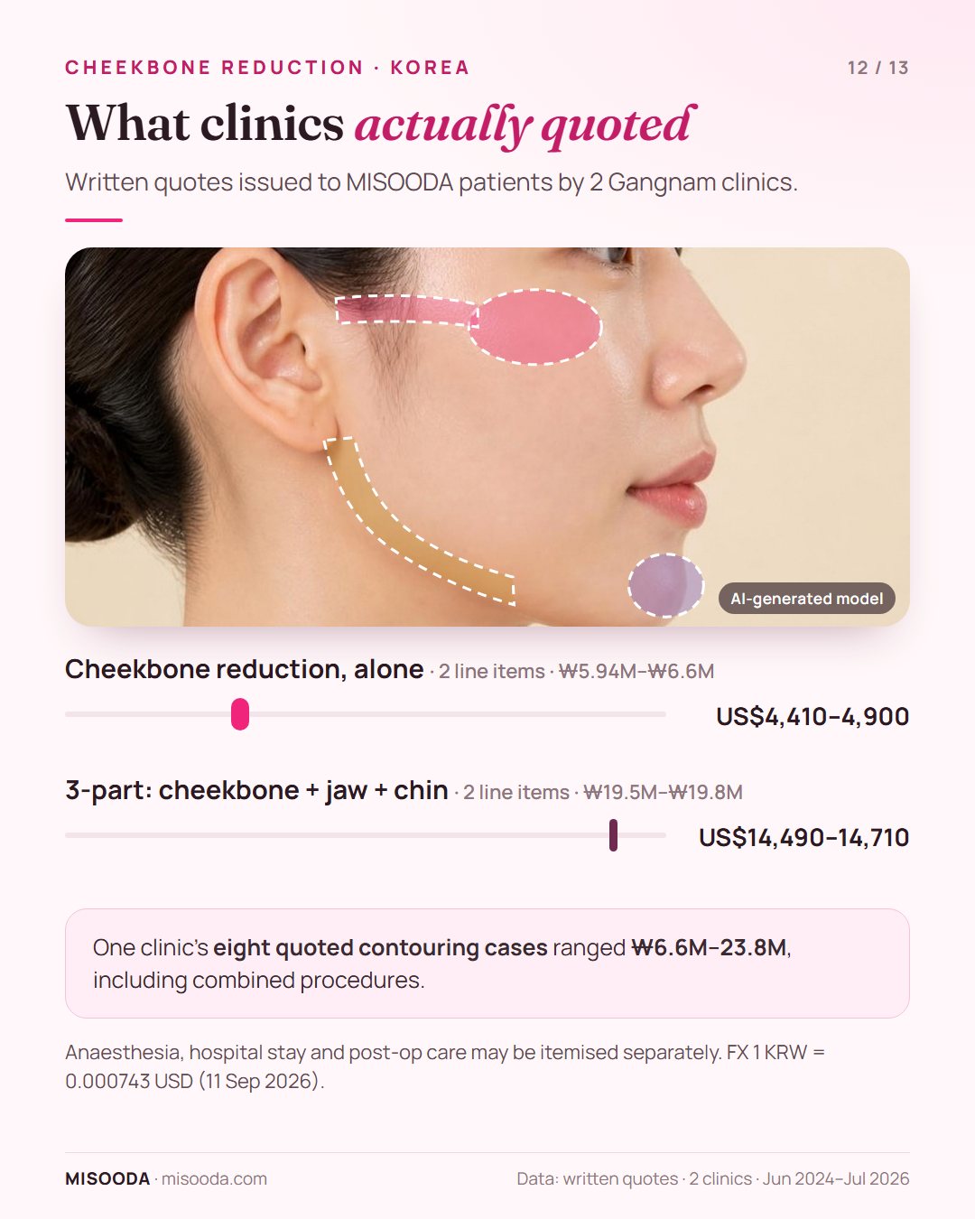 Real Korean cheekbone reduction quotes 2024–2026: zygoma reduction alone US$4,410–4,900, 3-part cheekbone, square jaw and chin contouring US$14,490–14,710