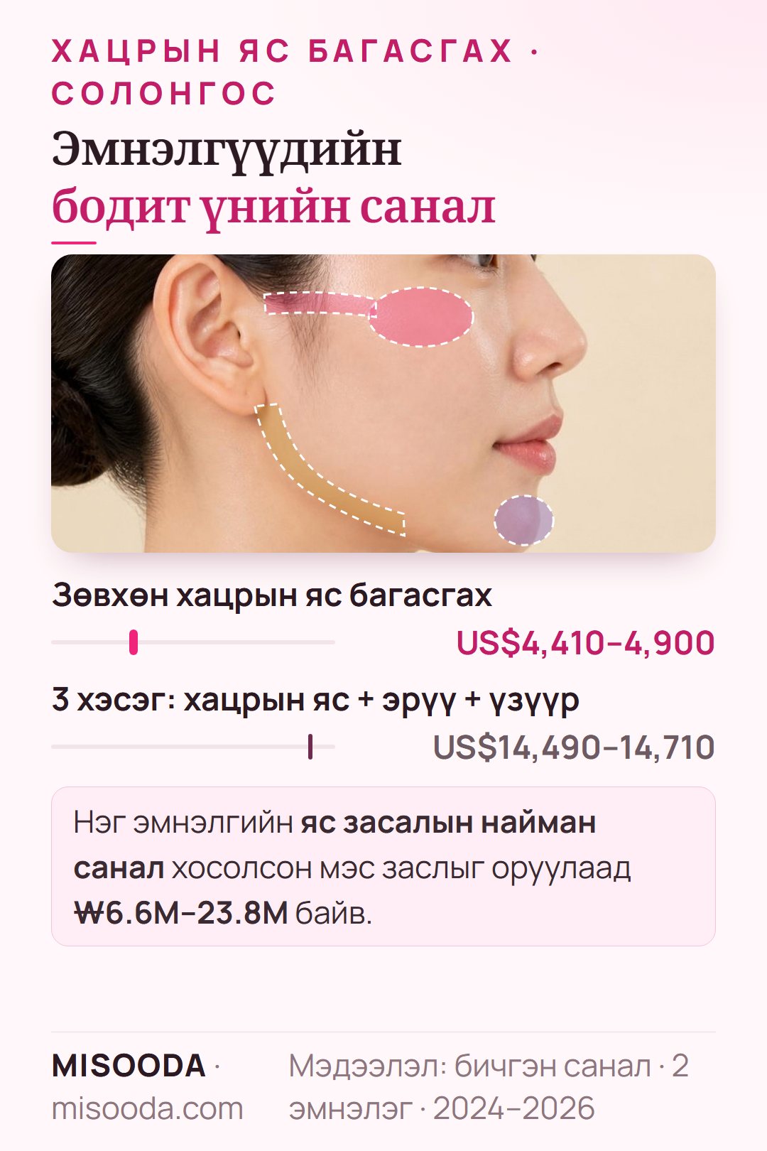 Солонгост хацрын яс багасгах бодит үнийн санал 2024–2026: зөвхөн зигома багасгах US$4,410–4,900, хацрын яс, дөрвөлжин эрүү, үзүүрийн 3 хэсэг US$14,490–14,710