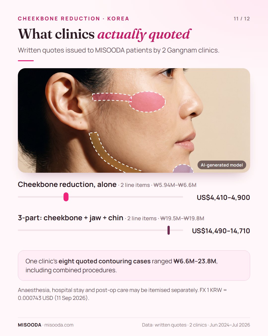 Real Korean cheekbone reduction quotes 2024–2026: zygoma reduction alone US$4,410–4,900, 3-part cheekbone, square jaw and chin contouring US$14,490–14,710