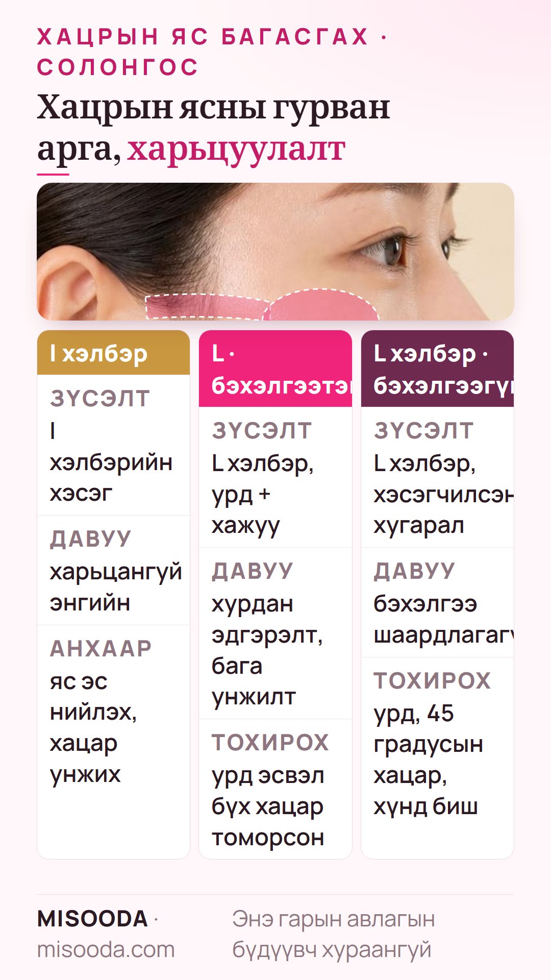 Солонгост хацрын яс багасгах аргын харьцуулалт: I хэлбэрийн остэктоми, бэхэлгээтэй ба бэхэлгээгүй L хэлбэрийн остэктоми, хэнд тохирох, сул тал