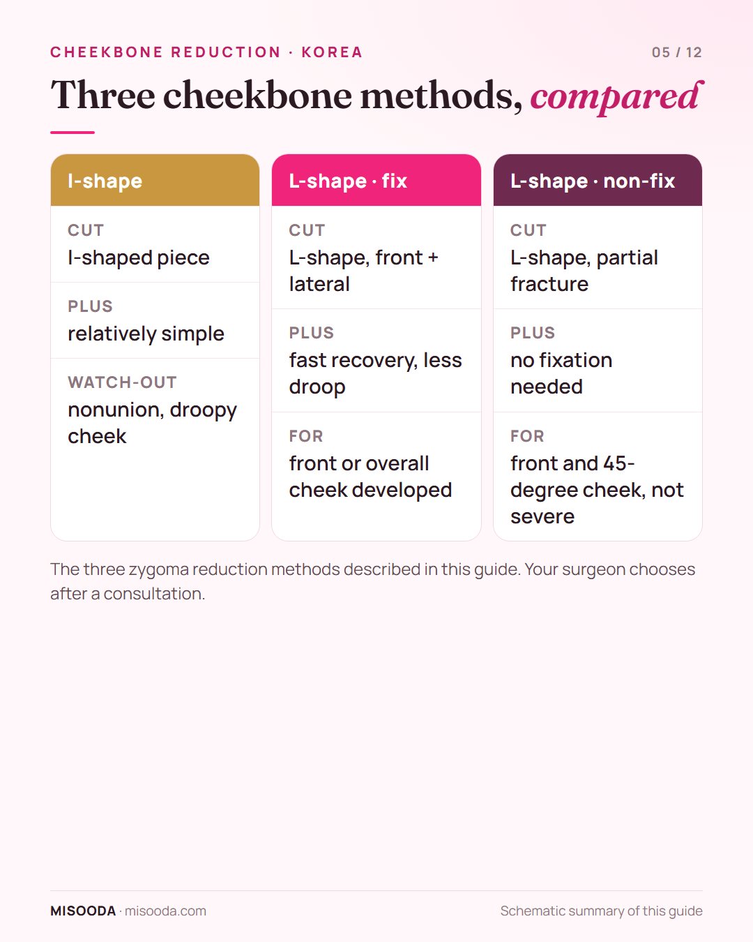 Cheekbone reduction methods compared: I-shape ostectomy, L-shape ostectomy with fixation and L-shape non-fix, with who each suits and their trade-offs