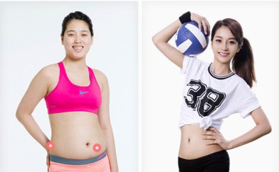 Confession: Born in Indonesia, beauty made in Korea  -  Korean Liposuction and Mini Face Lift