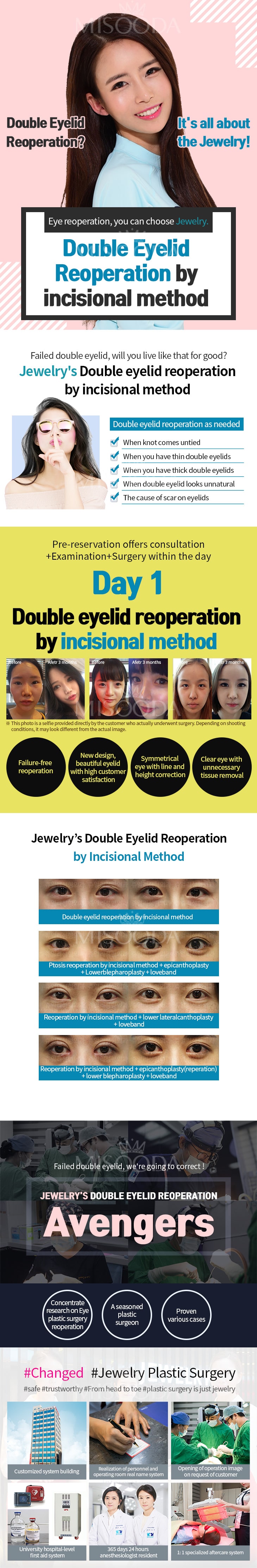 Double Eyelid Reopreation by incisional method (Contact MISOODA for price)