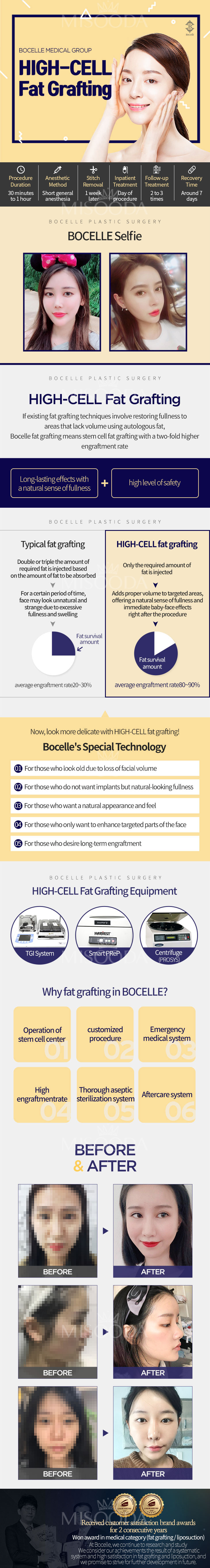 High-Cell Fat Grafting