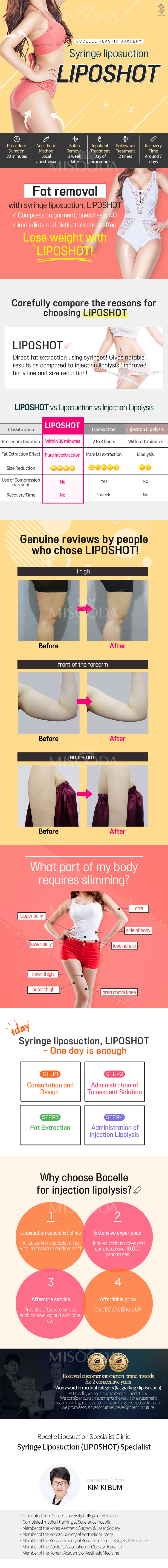 Syringe liposuction LIPOSHOT 100cc