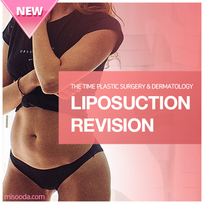 Liposuction Revision