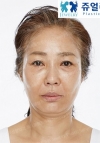 MISOODA Korean plastic surgery — Korea cost, reviews & before-after | MISOODA