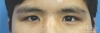 MISOODA Korean plastic surgery