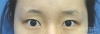 MISOODA Korean plastic surgery