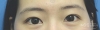 MISOODA Korean plastic surgery