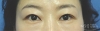 MISOODA Korean plastic surgery
