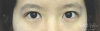 MISOODA Korean plastic surgery — Korea cost, reviews & before-after | MISOODA