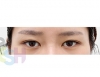 MISOODA Korean plastic surgery — Korea cost, reviews & before-after | MISOODA
