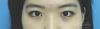 MISOODA Korean plastic surgery