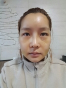 After 7 days