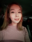 The most important thing is that I have no side effect until now. I can easily open my jaw and chew hard stuffs. I don’t have anything uncomfortable so far. If you are still considering, I want you to make decision now and become pretty like me. Look for best clinics and I hope this review helps everyone who reads it.