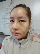 After 7 days