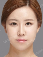 facial contouring