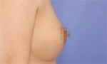 breast