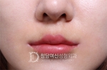 lip