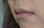 lip