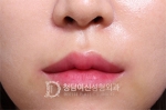 lip