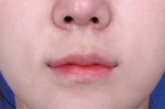 lip