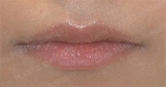 lip